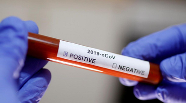 Médico en San Nicolás dio positivo por coronavirus
