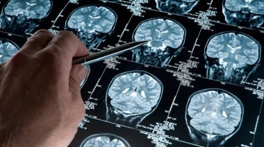 Un software argentino podría diagnosticar de forma precoz el Alzheimer